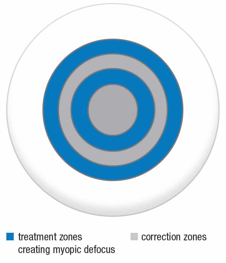Multifocal contact lens zones diagram